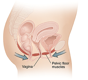 Side view cross section of female pelvis and abdomen showing pelvic floor muscles. Arrows show muscles contracting for Kegel exercise.