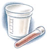 Image of urine sample