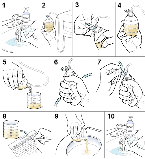 10 steps in how to empty a drain after surgery.