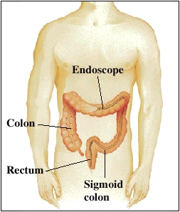 Colon and rectum