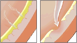 Image of lining of digestive tract