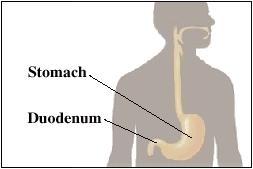 Image of stomach and duodenum