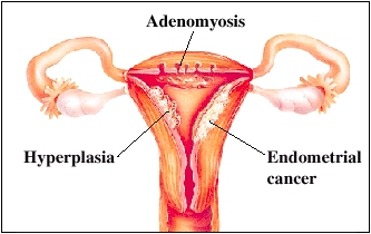 Cutaway view of uterus