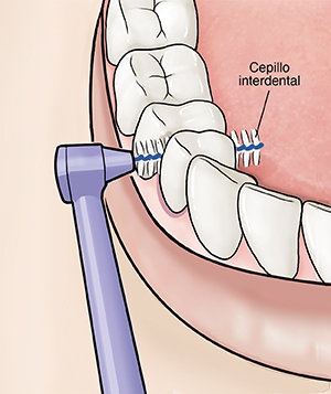 Primer plano de un cepillo interdental que limpia entre los dientes.