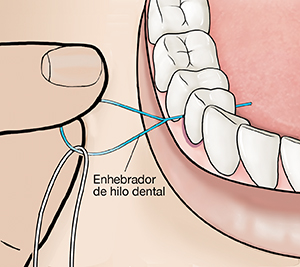 Primer plano de unos dedos que ubican el hilo dental entre los dientes con un enhebrador.