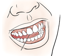 Primer plano de una boca en donde se ve el hilo entre los dientes.