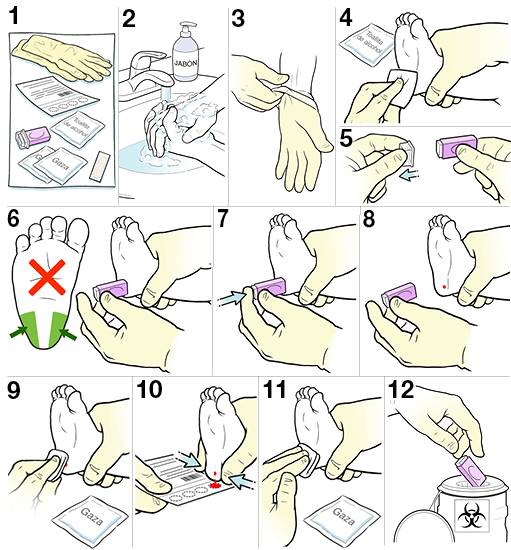 12 pasos para hacer una punción de talón a un bebé.