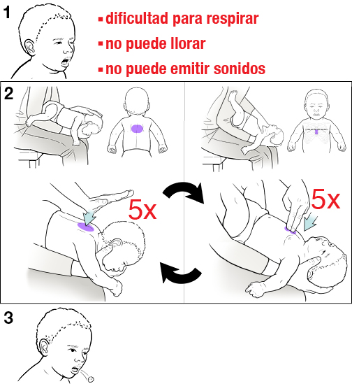 3 pasos para hacerle la maniobra de Heimlich a un bebé.