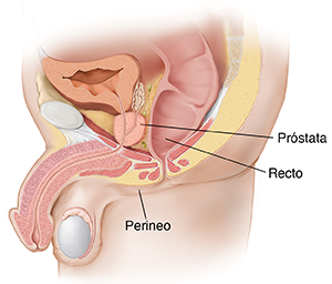Corte transversal visto de lado de un cuerpo masculino en el que pueden verse la próstata y el recto.