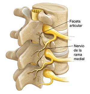 Vista tres cuartos de tres vértebras y discos donde se observan la médula espinal, los nervios espinales y los nervios de la rama medial.
