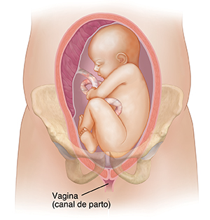 Vista frontal de un corte transversal de un útero en los huesos pélvicos donde se observa un feto con la cabeza hacia arriba, en presentación de nalgas.