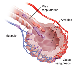 Primer plano de un bronquio y un alvéolo donde se observa tejido intersticial engrosado.