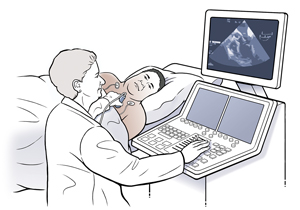 Hombre acostado de lado sobre una mesa de examen con cables de electrocardiograma en el pecho. Un técnico sostiene una sonda de ecografía sobre el pecho del hombre. 