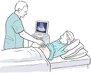 Mujer acostada sobre una camilla. Proveedor de atención médica sosteniendo un transductor de ultrasonido sobre el abdomen de la mujer y mirando la imagen en el monitor.