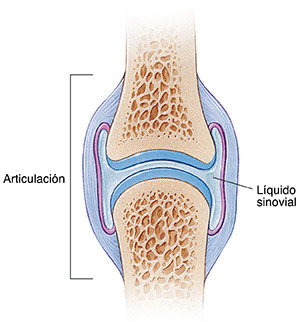 Corte transversal de una articulación sana donde se observan la cápsula articular y el líquido sinovial.