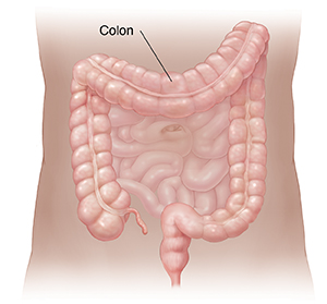 Contorno del abdomen donde pueden verse el intestino delgado y el colon.