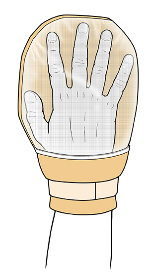 Primer plano de una mano cubierta por un guante de restricción.