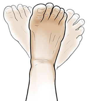 Foot with ghosted-in positions showing foot rotating.