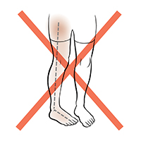Front view of legs showing one foot and leg rotated towards the middle. Red X indicates not to do this.
