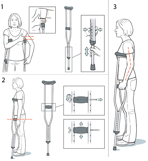 3 steps in fitting crutches.