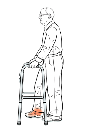 Man stepping into walker with injured foot, using the weight bearing technique.