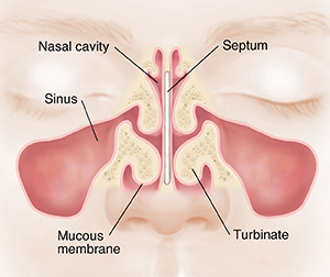 Front view of face showing sinuses and septum.