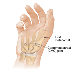 Palm view of hand showing bones and carpometacarpal joint.