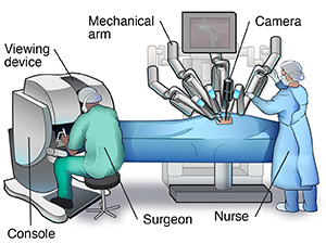 Operating room showing surgical staff using a robotic surgical device.
