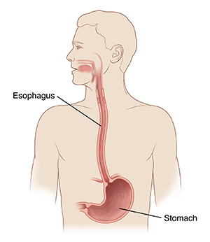 Outline of human head and chest with head turned to side. Cross section of esophagus leading from mouth to stomach is shown.