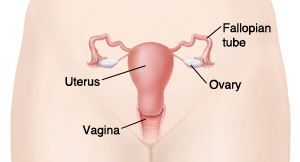 Outline of woman's pelvis showing vagina, uterus, fallopian tubes, and ovaries.