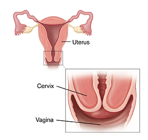 Cross section of uterus with inset showing closeup of cervix.