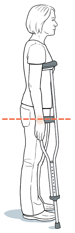 Side view of woman standing with crutch under arm. Dotted line shows wrist lining up with crutch handle.