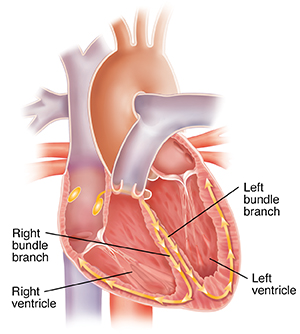 Cross section of heart showing left and right bundle branches.