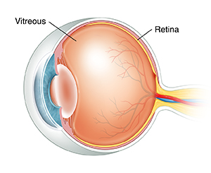 Three-quarter view cross section of eye showing vitreous.