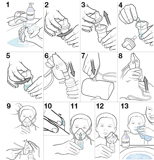 13 steps for a child's using a nebulizer with a mask
