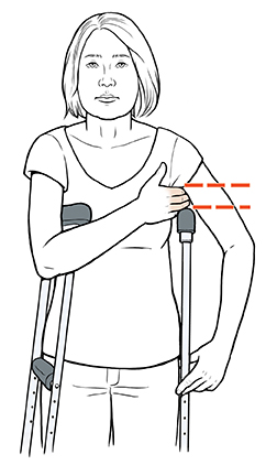Woman with crutches holding three fingers between armpit and top of crutch.