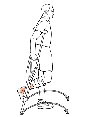 Side view of man using crutches with arrow showing where to put crutches after swinging foot through for the swing through technique.