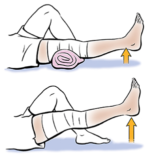 1. Pierna desde la rodilla hacia abajo que muestra las extensiones de rodilla de arco corto. 2. Pierna desde la rodilla hacia abajo que muestra la elevación de pierna extendida.