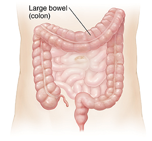 Outline of abdomen showing small intestine and colon.