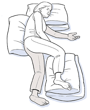 Mujer acostada sobre un lado debido a un accidente cerebrovascular, con la espalda, la cabeza y la pierna no afectada apoyadas sobre almohadas.