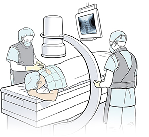 Proveedor de atención médica con delantal de plomo y guantes quirúrgicos dándole una inyección en el cuello a un paciente que está recostado en una mesa de operaciones.