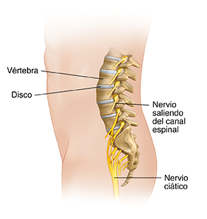 Vista lateral de una figura masculina donde se observa la anatomía de la columna lumbar y el nervio ciático.