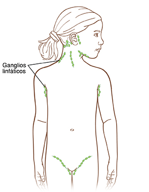 Contorno de un niño que muestra los ganglios linfáticos delante y detrás de la oreja, en los laterales y parte trasera del cuello, debajo del mentón, en las axilas y en la entrepierna.
