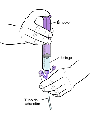 Primer plano de una mano que sostiene un tubo de extensión con una jeringa insertada en un puerto. La otra mano empuja el émbolo de la jeringa.