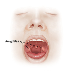 Vista frontal de la cara con la boca abierta donde se observan la cavidad bucal y las amígdalas.