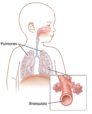 Imagen frontal de un bebé con la cabeza girada, donde se aprecian su anatomía respiratoria. El recuadro muestra un primer plano de los bronquiolos y los alvéolos.