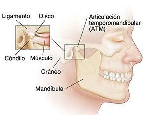Vista lateral de una cabeza en donde puede verse la articulación temporomandibular. El recuadro muestra la anatomía de la articulación temporomandibular en primero plano.