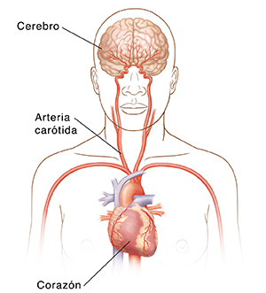 Vista frontal de la cabeza y la parte superior del cuerpo en donde pueden verse las arterias carótidas, el corazón y el cerebro.