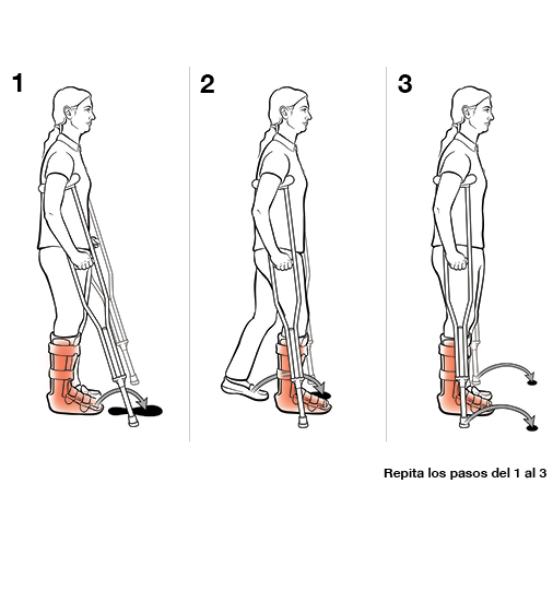 Tres pasos para usar muletas y dar un paso hacia adelante (con soporte de peso).