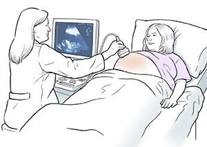 Proveedora de atención médica haciéndole una ecografía a una mujer embarazada.
